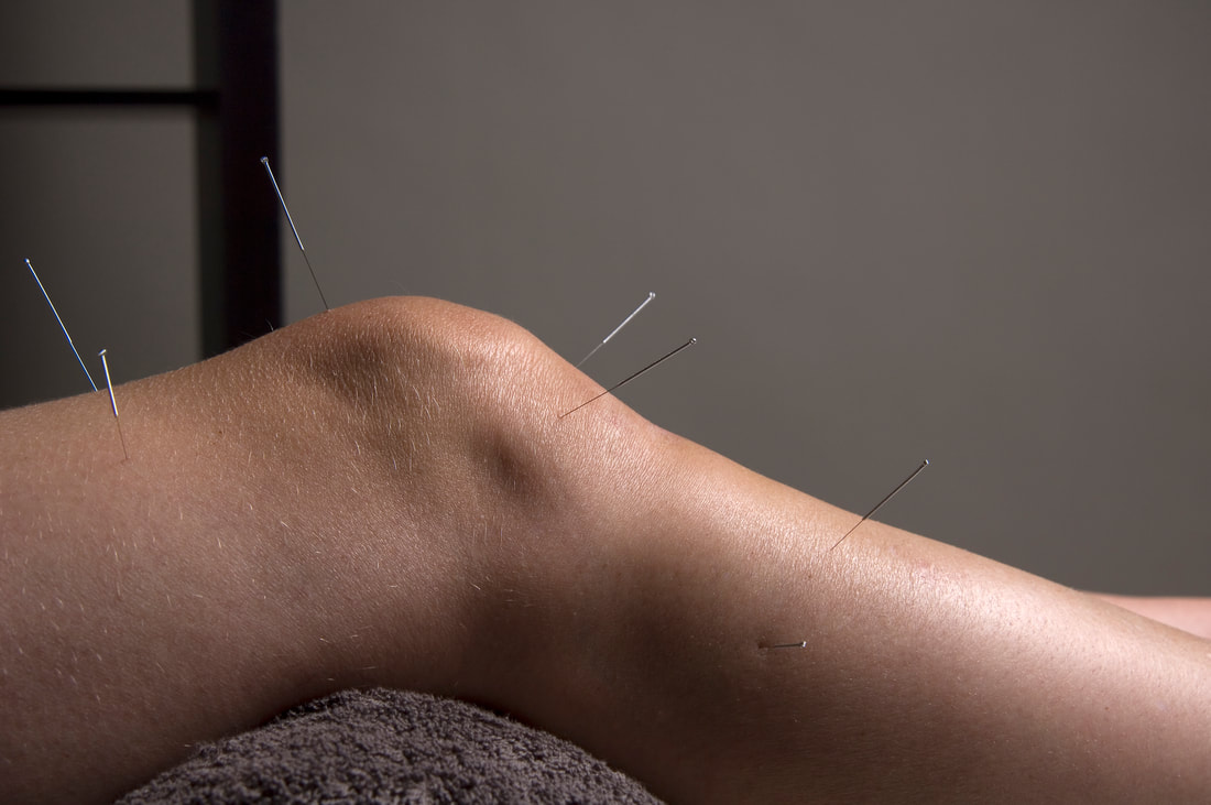 Knee acupuncture picture