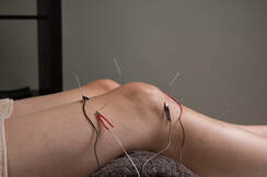 Knee Electroacupuncture Picture